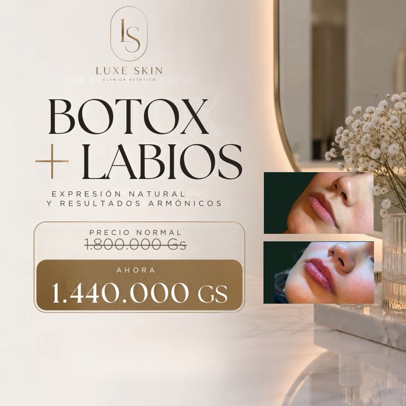 Combo Botox + Relleno de Labios: precio normal 1.800.000 Gs, ahora 1.440.000 Gs