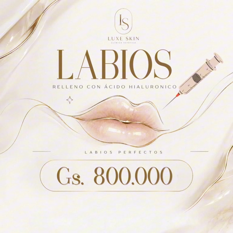 Relleno de labios con ácido hialurónico, 800.000 Gs