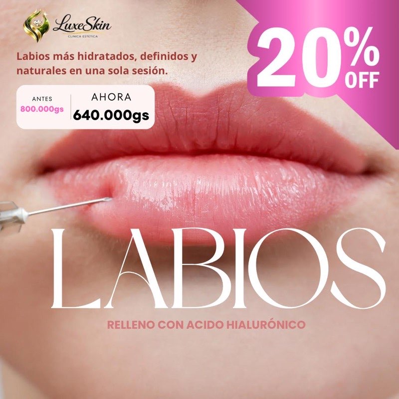 20% OFF en Relleno de Labios